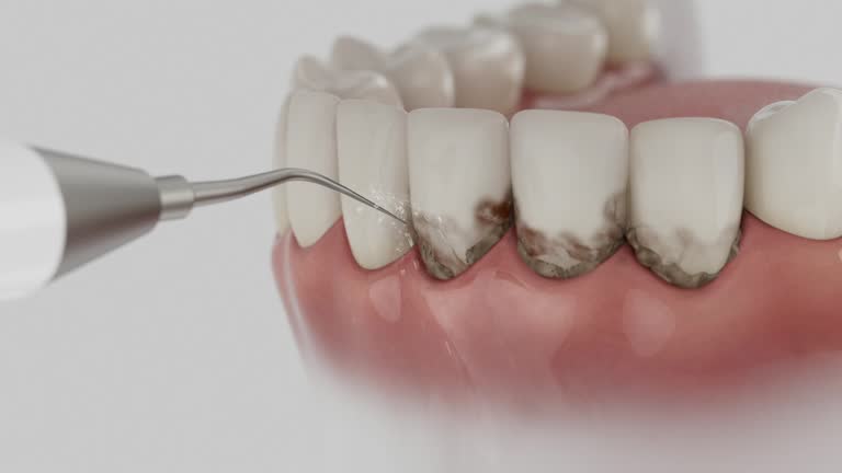 Reliable Dental contractor in Hidden Meadows, CA by Smile Center Dentistry
